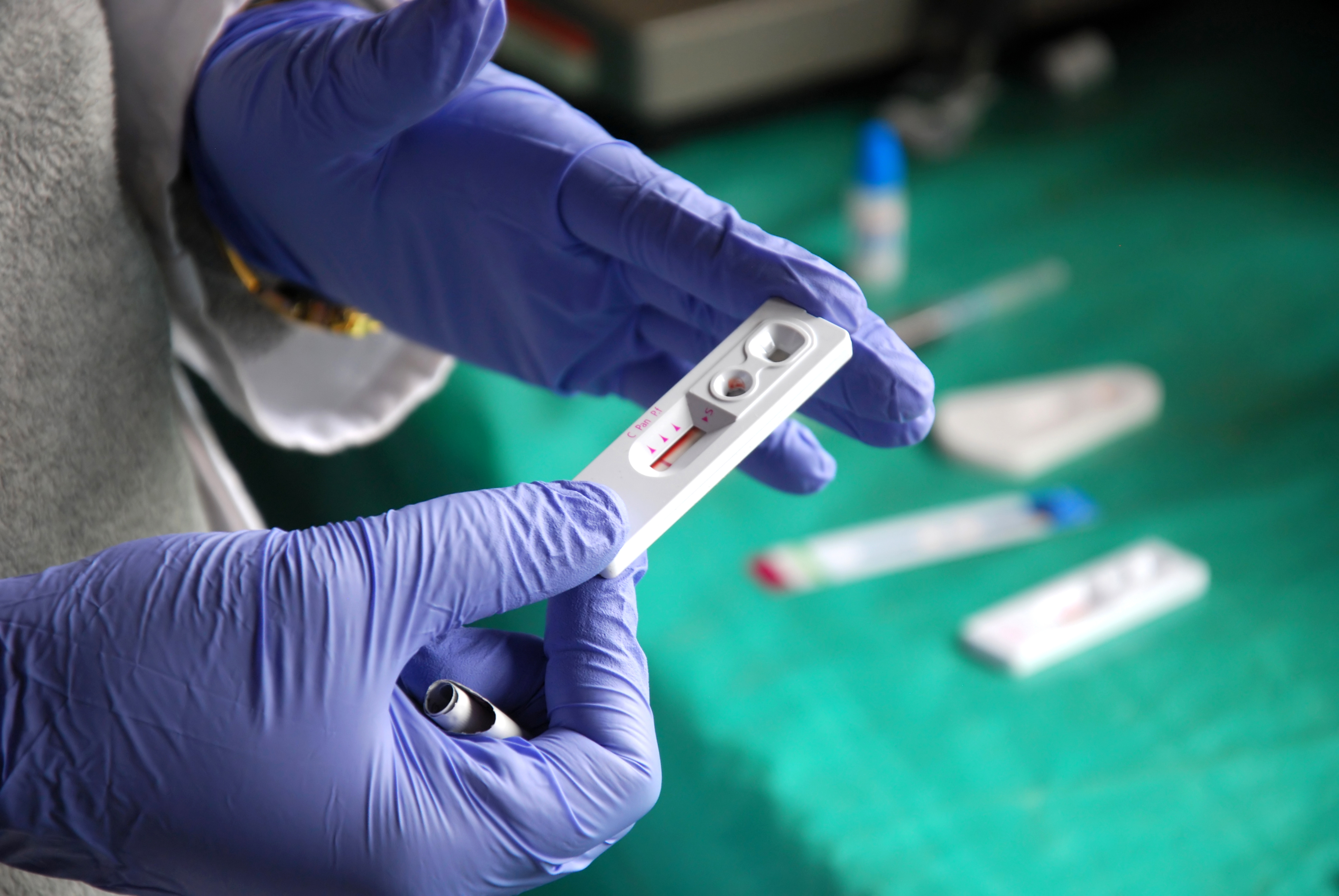 person wearing gloves holding HIV test