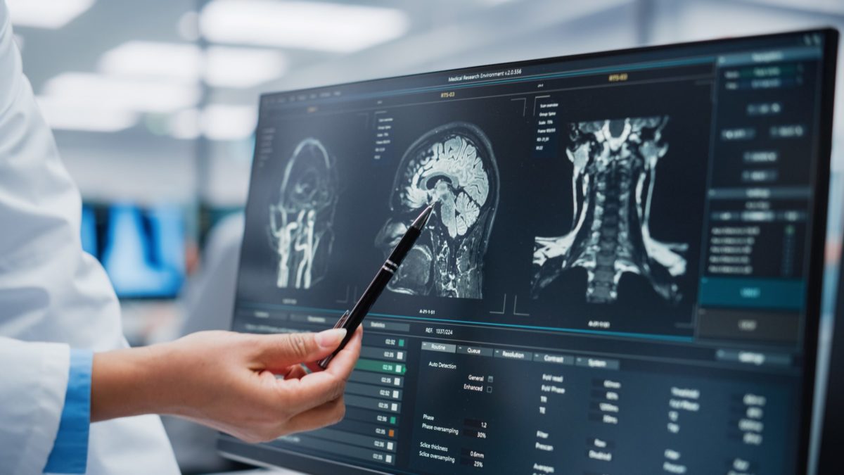 Medical Hospital: Neurologist and Neurosurgeon Talk, Use Computer, Analyse Patient MRI Scan, Diagnose Brain. Brain Surgery Health Clinic Lab: Two Professional Physicians Look at CT Scan. Close-up.