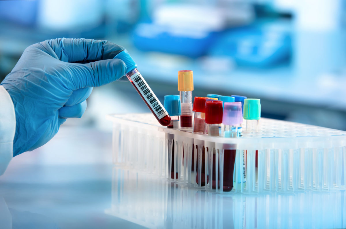 Technician holding tube of blood for testing in the research laboratory.