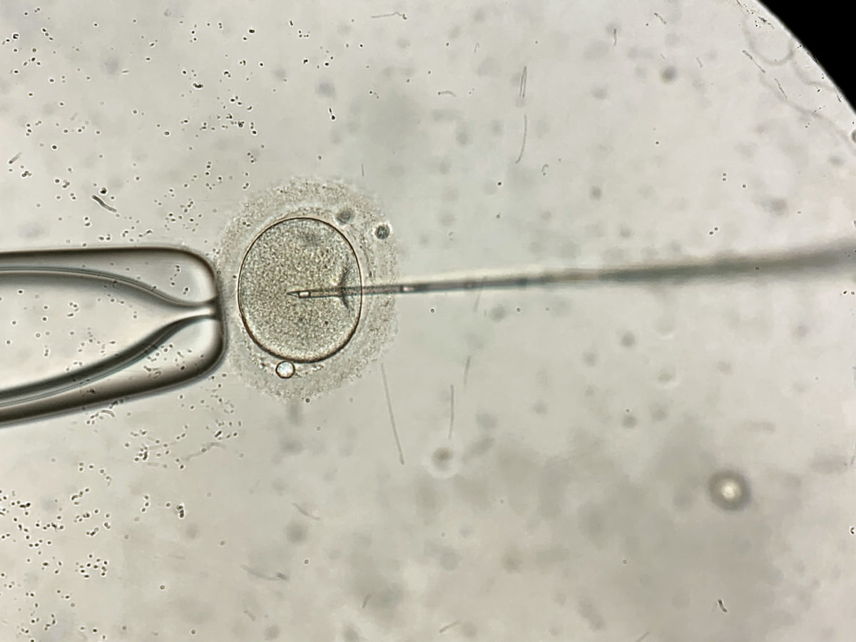 Remarkable macro view through the microscope at process of the in vitro fertilization of a female egg inside IVF dish in the laboratory. Horizontal.