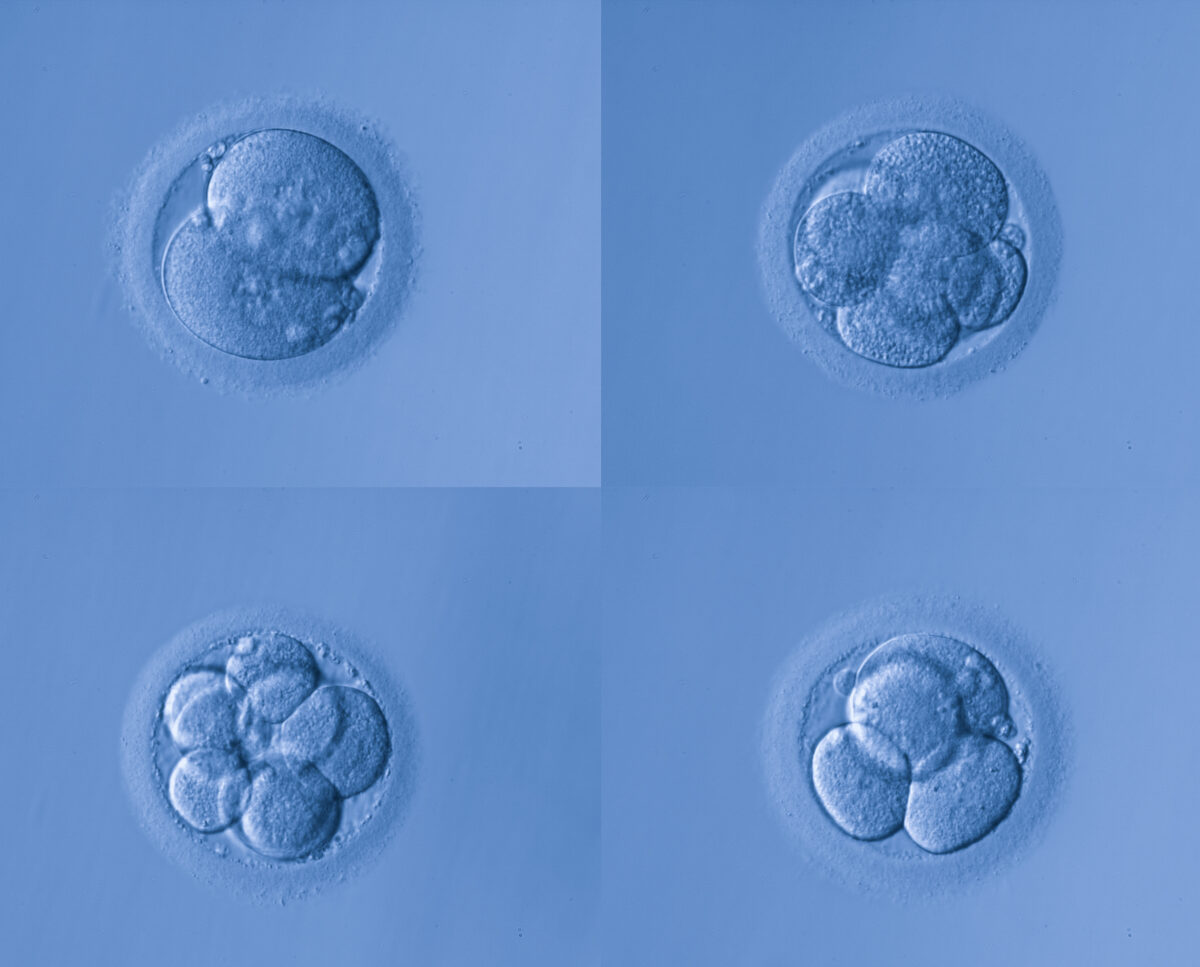 Fertilized human egg cells dividing.